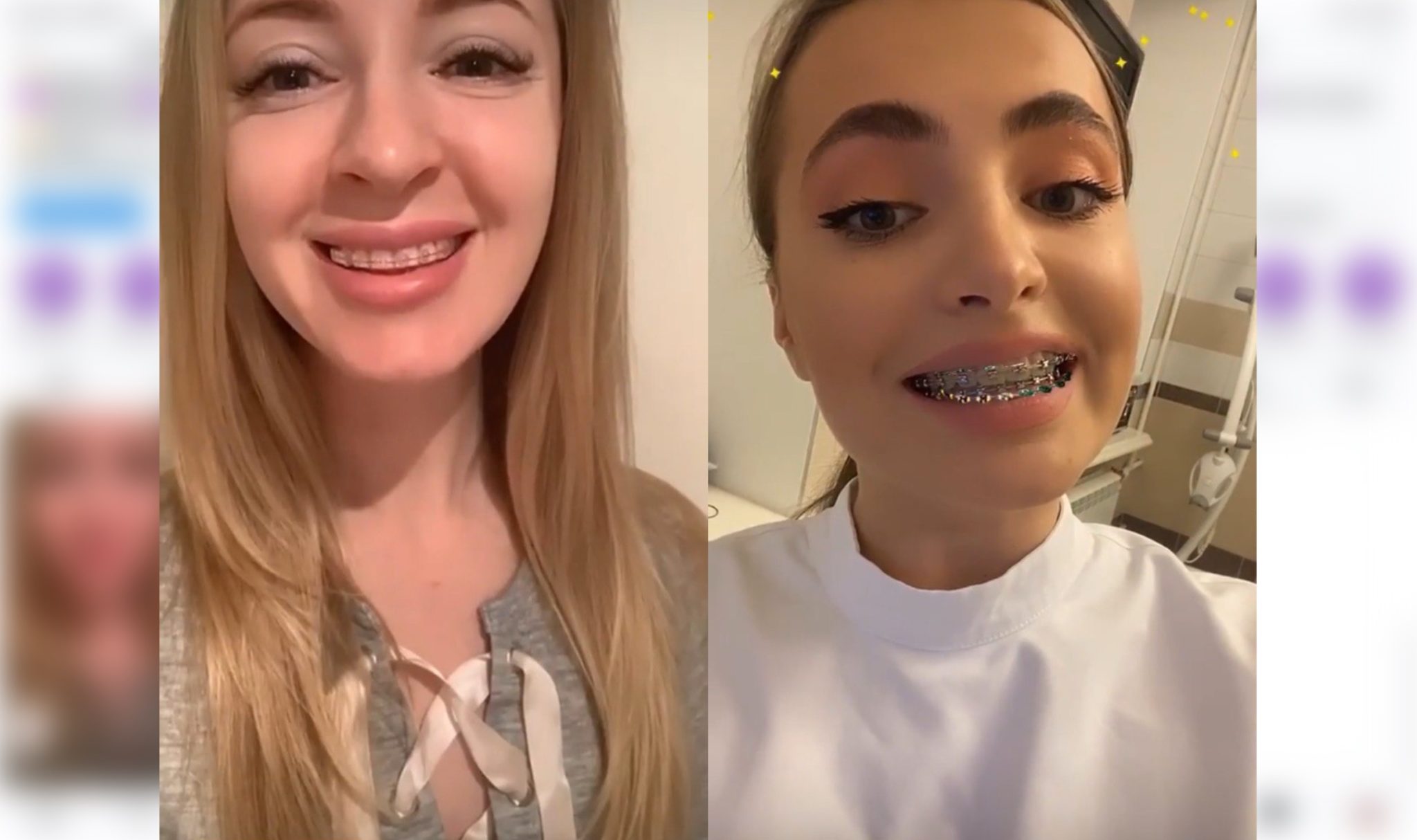 Маска брекеты примерить. Лицевая маска диляра ортодонтия. Лицевая дуга ортодонтия. Аппарат для выравнивания челюсти. Маска брекеты примерить.